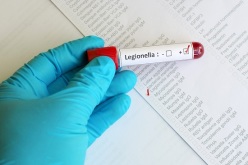 Legionella: incontro di formazione sulle nuove linee guida di sorveglianza e controllo