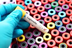 Legionella: attenzione alle novità
